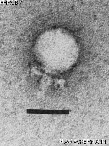 HER101 Image of phage under microscope