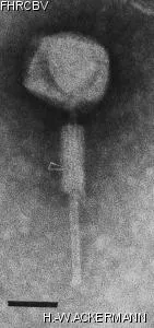 HER107 Image of phage under microscope