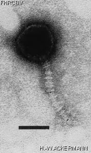 HER112 Image of phage under microscope