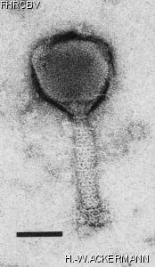 HER114 Image of phage under microscope