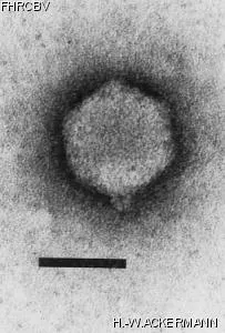 HER121 Image of phage under microscope