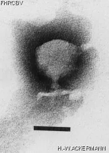 HER131 Image of phage under microscope