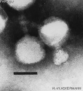 HER135 Image of phage under microscope