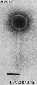 HER136 Image of phage under microscope