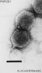 HER138 Image of phage under microscope