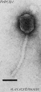 HER139 Image of phage under microscope