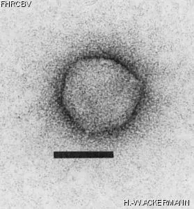 HER140 Image of phage under microscope