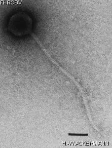 HER143 Image of phage under microscope