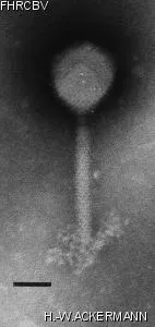 HER147 Image of phage under microscope