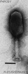 HER150 Image of phage under microscope