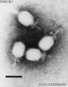 HER159 Image of phage under microscope