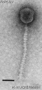 Image of phage under microscope