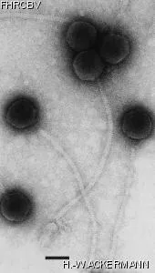 HER163 Image of phage under microscope