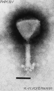 HER165 Image of phage under microscope