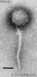 HER166 Image of phage under microscope