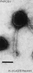 HER167 Image of phage under microscope