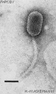 Image of phage under microscope