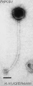 HER175 Image of phage under microscope