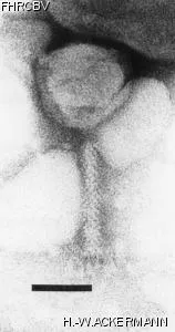 HER176 Image of phage under microscope