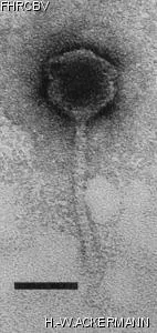 HER177 Image of phage under microscope