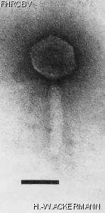 HER180 Image of phage under microscope