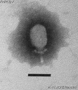 HER182 Image of phage under microscope