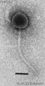 HER184 Image of phage under microscope