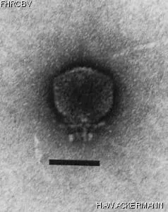 HER185 Image of phage under microscope