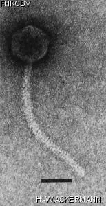 HER186 Image of phage under microscope