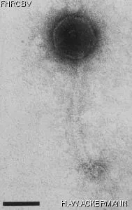 HER192 Image of phage under microscope