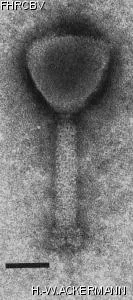 HER199 Image of phage under microscope