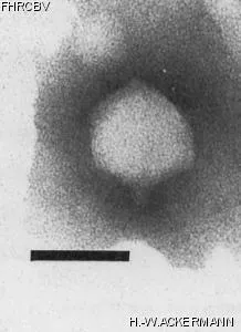 HER200 Image of phage under microscope