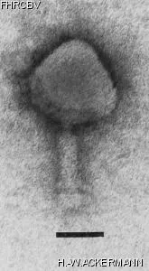 HER202 Image of phage under microscope