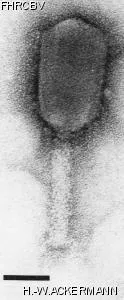 HER209 Image of phage under microscope