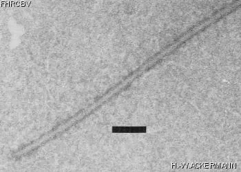 HER213 Image of phage under microscope