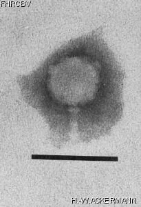 HER219 Image of phage under microscope