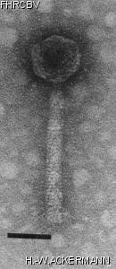 HER220 Image of phage under microscope