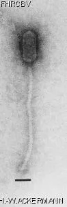 HER225 Image of phage under microscope