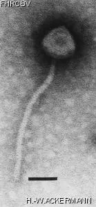 HER226 Image of phage under microscope