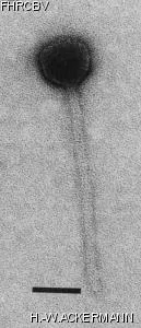 HER229 Image of phage under microscope
