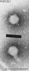 HER23 Image of phage under microscope