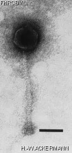 HER239 Image of phage under microscope