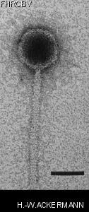 HER24 Image of phage under microscope