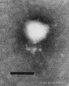 HER242 Image of phage under microscope