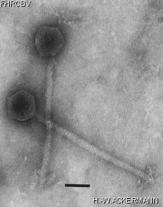 HER246 Image of phage under microscope