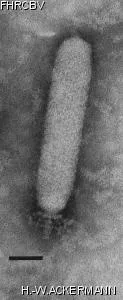 HER248 Image of phage under microscope