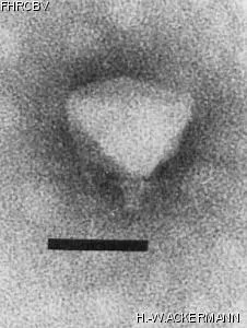 HER249 Image of phage under microscope