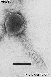 HER262 Image of phage under microscope