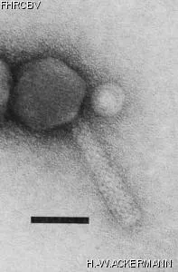 Image of phage under microscope