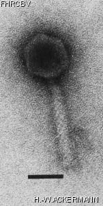 HER272 Image of phage under microscope